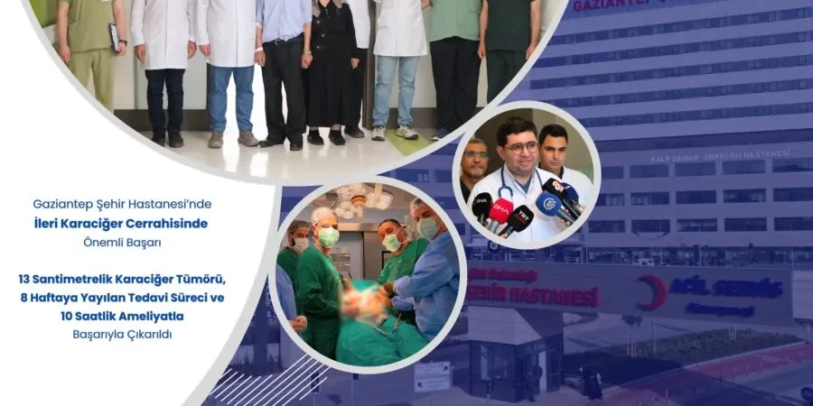 Gaziantep Şehir Hastanesi’nde İleri Karaciğer Cerrahisinde Önemli Başarı 3 20260701_164056